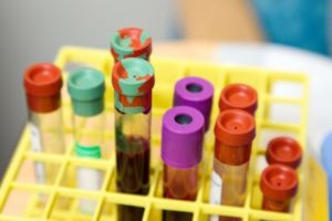 CDC выпустили рекомендации по тестированию при гепатите неизвестной этиологии