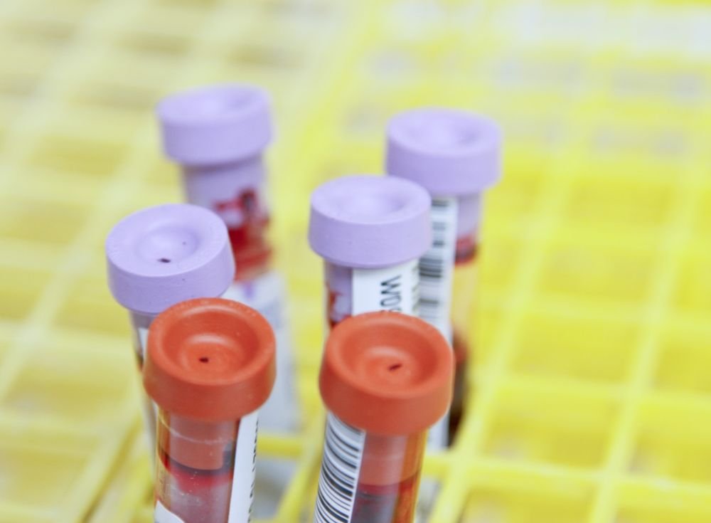 Анализы крови помогут лечить детский рак более умно